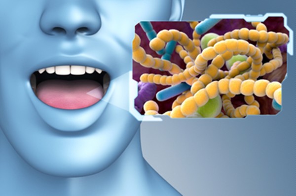 [이미지 자료] 전신 건강에 영향 끼치는 입 속 유해균