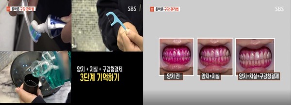 3단계 구강관리법.