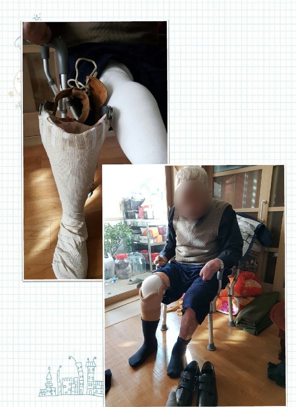 보장구 지원사진