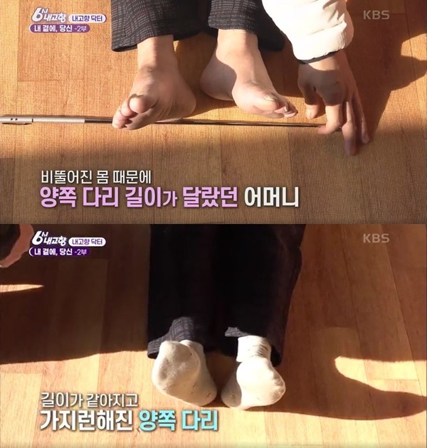 KBS 1TV 6시 내고향 ‘떴다! 내고향 닥터’ 방송 캡쳐