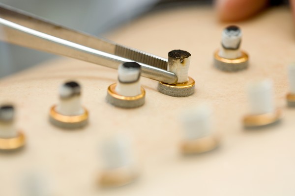 [사진설명] 뜸치료는 유방암 치료후유증 중 하나인 림프부종 증상완화에 효과가 있는 것으로 분석됐다.