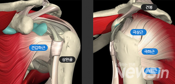 회전근개 이미지 