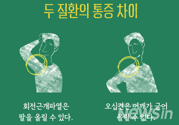 회전근개파열과 오십견의 통증 차이