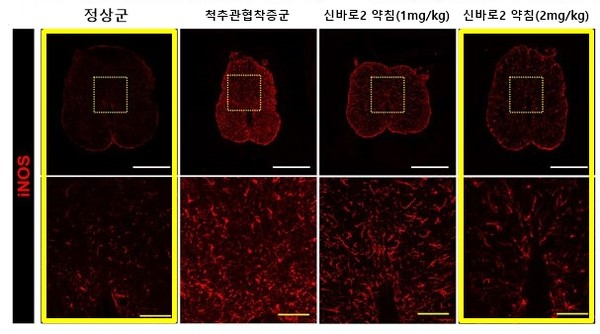 [사진설명] 신바로2약침 농도에 따라 붉은색으로 표시된 염증 매개 인자(iNOS)의 발현이줄어드는 모습