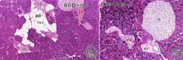 (10A) 지방 세포(FAT)는 인슐린을 분비하는 IS에 축적. 정상적인 쥐에서는 췌장에 지방이 축적되는 현상이 드물지만, 비만 쥐에서는 이러한 현상이 발생. (10C) 씨폴리놀을 60일 동안 급여한 쥐는 조직 세포내 지방 방울이 감소하고, 랑거한스섬(IS)과 관련된 지방 세포가 관찰되지 않음. Dept. of Pathology, Univ. of Washington, USA