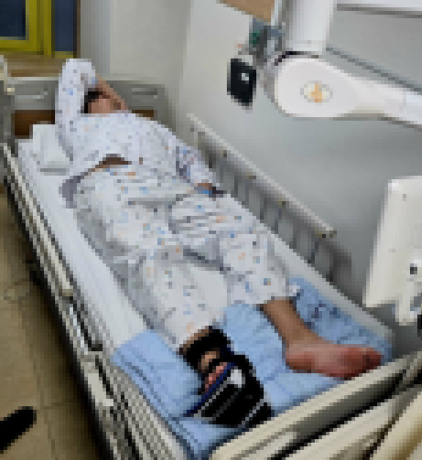 전치 3주의 상해 진단을 받은 A씨.