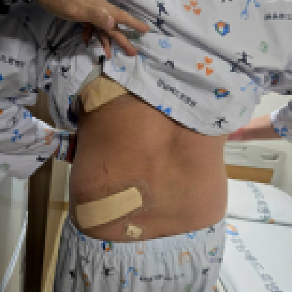 전치 3주의 상해 진단을 받은 A씨.